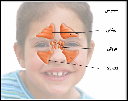 سینوزیت شایع ترین بیماری در فصل سرد سال
