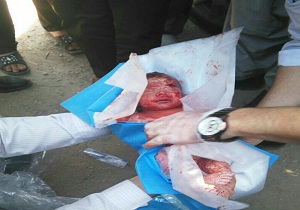 خاطرات راننده ماشین حمل زباله از مشاهده جنین های متعدد درمیان نوزادها
