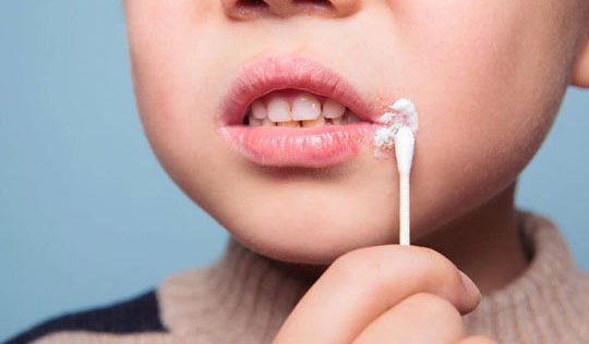 12 واقعیتی که خطوط و جوش های صورت از وضعیت سلامتی‌تان می‌گویند