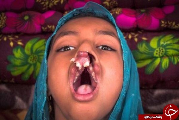 دختر عجیب