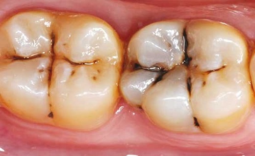 وسواس در ورزش چیست/ گوشتی مناسب برای رژیم لاغری/ علت پیچ خوردگی های مچ پا چیست