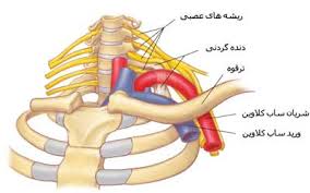 عارضه دنده گردن چیست؟