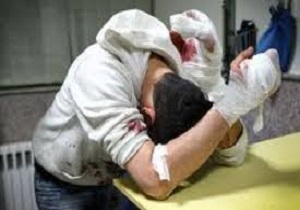 جیندی ویژه چهارشنبه&zwnj;سوری *** کمبود تخت&zwnj; ویژه بیماران سوختگی در کشور/ سالیانه 2500 نفر در اثر سوختگی جان خود را از دست می&zwnj;دهند