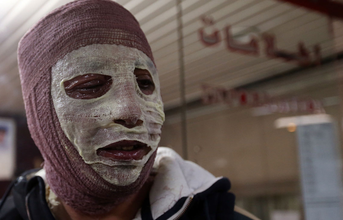 انفجار مواد محترقه در یک ساختمان مسکونی/ دو نوجوان دچار سوختگی شدند