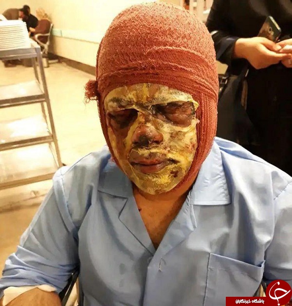 حوادث تلخی که در چهارشنبه سوری امسال رخ داد + تصاویر حوادث تلخی که در چهارشنبه سوری امسال رخ داد + تصاویر