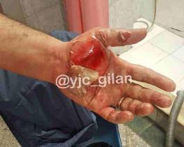 مصدومیت بیش از ۱۴۰ گیلانی در شب چهارشنبه سوری