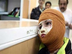 مصدومیت 130 نفر در چهارشنبه آخر سال استان زنجان
