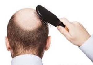 خبرنگار:&zwnj; جنیدی/ ویژه عید/راه&zwnj;های جلوگیری از ریزش مو/ چگونه موهای خود را تقویت کنیم