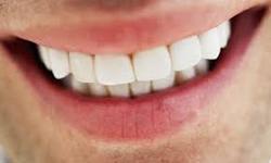 ۲۰ چیز که لبخندتان را ویران میکند