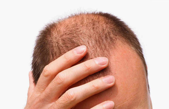 5 رازی که باید درباره مکمل&zwnj;های پوست، مو و ناخن بدانید