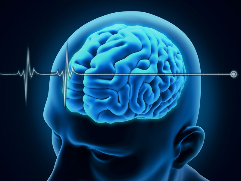 همه چیز درباره مرگ ناگهانی یک مغز