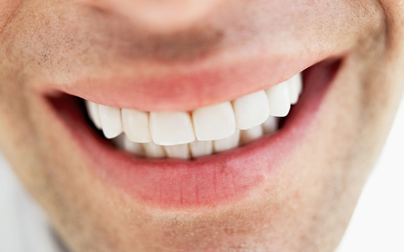 چگونه به فرمول یک لبخند زیبا برسیم؟