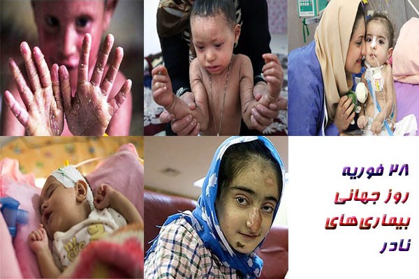 بیماران نادر زیر چتر بیمه سلامت قرار بگیرند/ اطلس بیماری های نادر در دست پزشکان