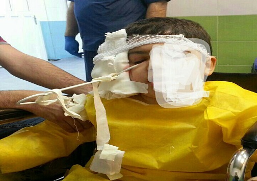 شئخی خطرناک منجر به اسیب دیدگی چشم شد+تصویر