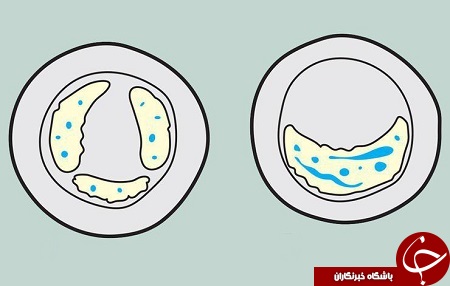 تپش قلب ورزشکاران چگونه است؟ + تصاویر