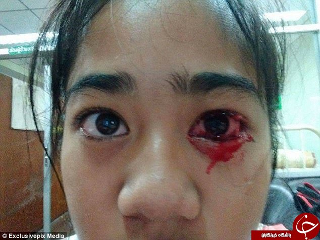 دختری که خون گریه می&zwnj;کند! +تصاویر