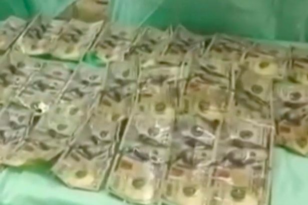 این زن 7000 دلار را بلعیده بود+ فیلم