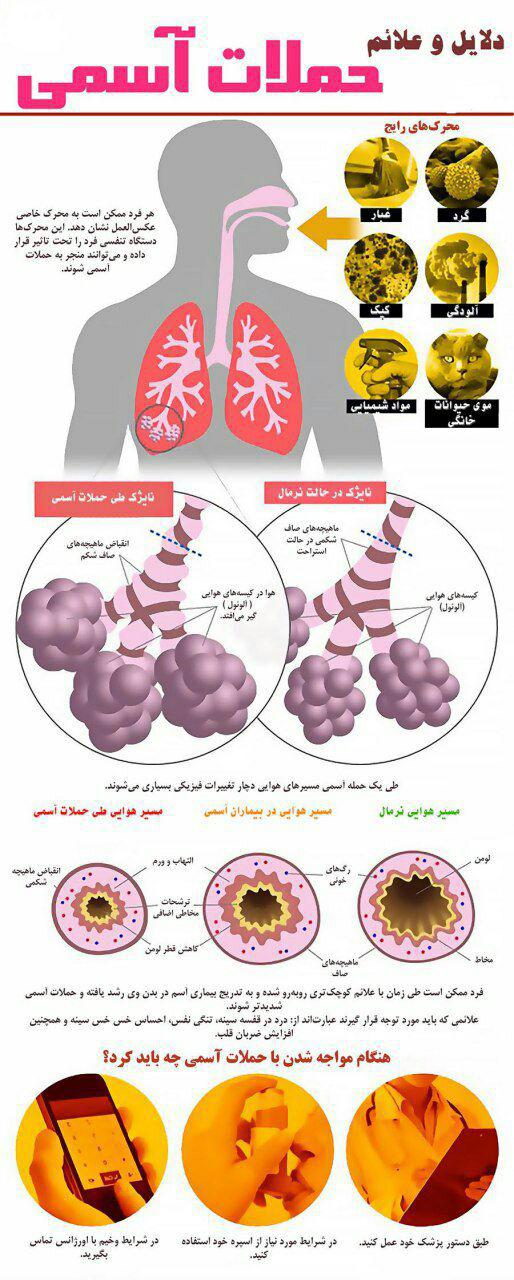 آسم و راهکارهای مقابله با حملات آن+ اینفوگرافی