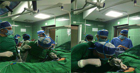 انجام عمل جراحی به روش مدیکال توراکوسکپی
