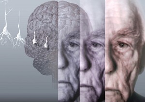 روش‌های بدیع درمان آلزایمر/ این آنتی‌بادی‌ها به بیماری شبیخون می‌زنند