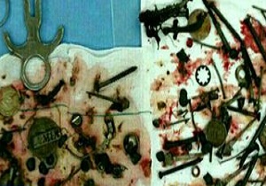 جا خوش کردن ۱۵۰ قطعه فلزی در شکم بیمار مشهدی +عکس