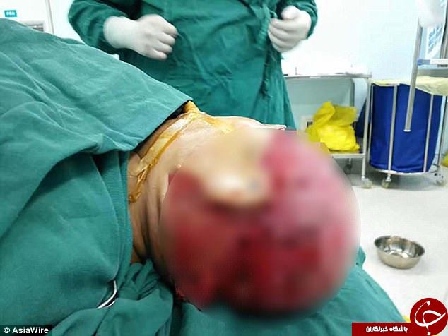 پوست سر مرد بیچاره در حین کار کنده شد+ تصاویر