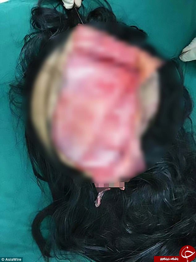 پوست سر مرد بیچاره در حین کار کنده شد+ تصاویر