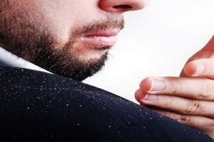شوره سر می تواند نشانه چه باشد؟