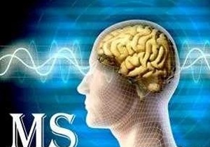 ام‌اس، ۵ سال قبل از حمله‌ علامت می‌دهد