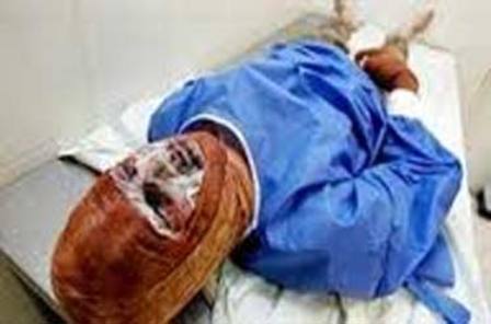 درمان عفونت های ناشی از سوختگی با پلاسمای سرد برای اولین بار در کشور