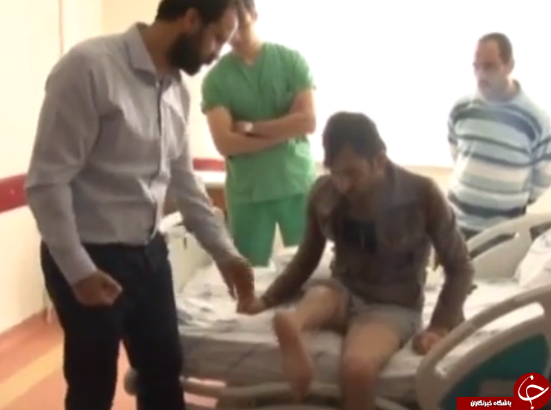 پایی که بالعکس پیوند زده شد