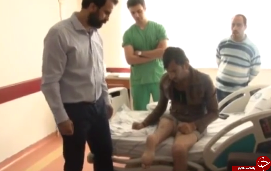 پایی که بالعکس پیوند زده شد