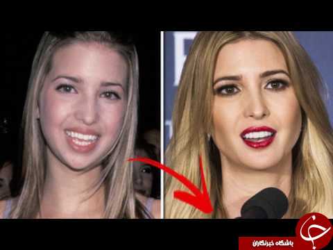 آیا این واقعیت در مورد ایوانکا ترامپ واقعیت دارد+ تصاویر