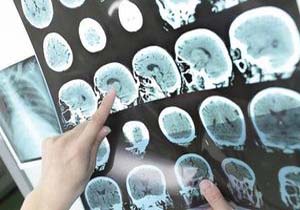 استفاده از هوش مصنوعی برای رمزگشایی فعالیت مغز