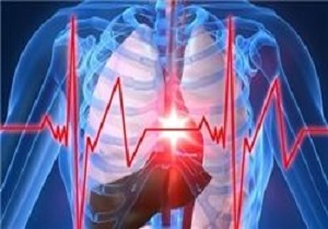 بازگشت به زندگی پس از ایست کامل قلبی