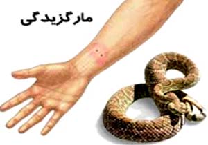 مارگزیدگی پیرمرد بابلی