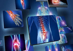 6 خوراکی برای ضربه فنی کردن درد مفاصل شما