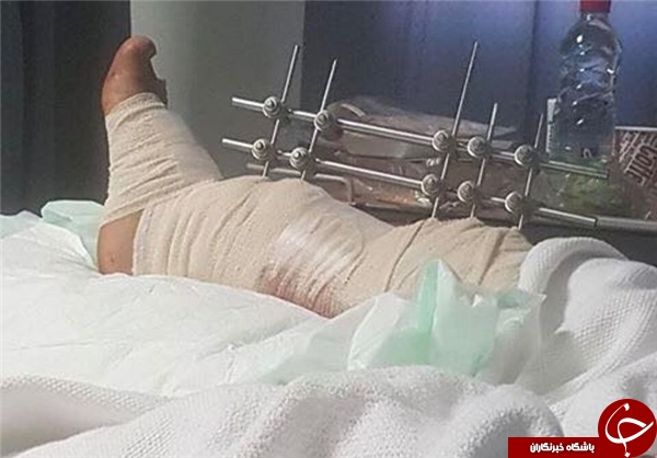 تیراندازی سعودی&zwnj;ها به برادر شیخ نمر +عکس