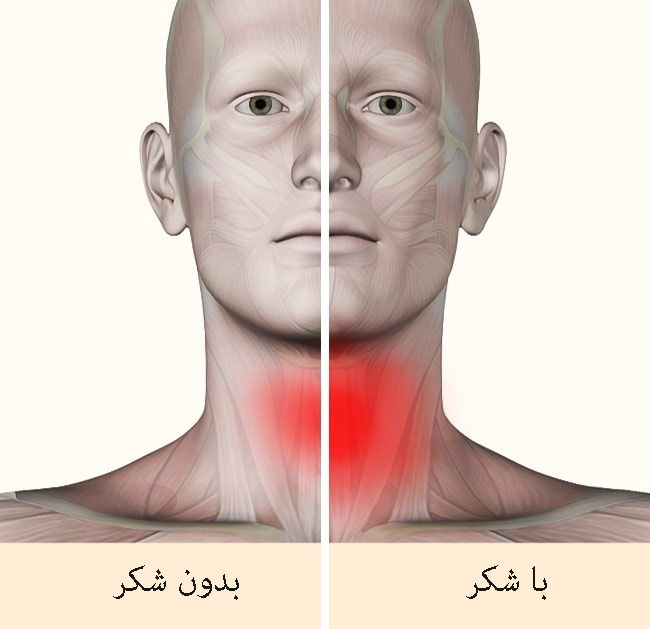 خطرناک ترین خواص شکر+تصاویر