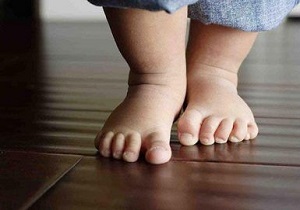 صافی کف پا و پای پرانتزی شایع‌ترین بیماری‌های ارتوپدی اطفال