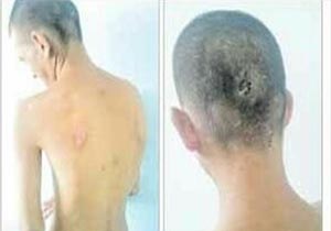 تکذیب خبر ضرب و شتم معلول ذهنی در مرکز توانبخشی