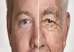 مردان و زنان ایرانی، چرا زود پیر می شوند؟