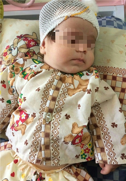 شیره تریاک تجویز همسایه برای کودک ۳ ماهه +عکس