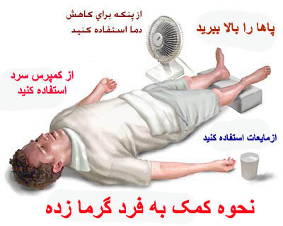 چگونه گرمازدگی را درمان کنیم؟