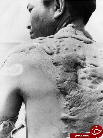 استقبال بازماندگان حمله اتمی به ژاپن از قطعنامه سازمان ملل متحد در خصوص سلاح های هسته&zwnj;ای