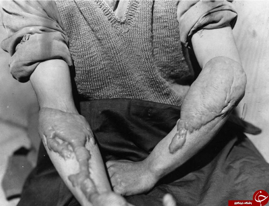 استقبال بازماندگان حمله اتمی به ژاپن از قطعنامه سازمان ملل متحد در خصوص سلاح های هسته&zwnj;ای