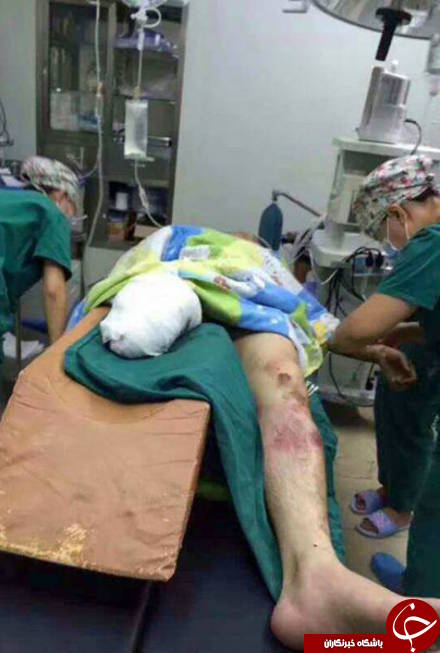 راننده فداکار قطار، حین نجات زن سالخورده ناشنوا پایش را از دست داد + تصاویر