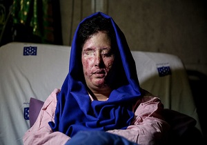 "سهیلا" نور را می‌بیند/هنوز پولی از ایران نرسیده است