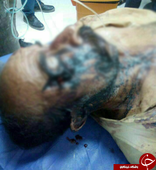 حمله یوز پلنگ به مرد بشاگردی