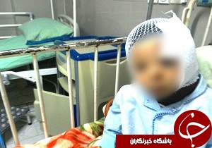 سوختگی بر اثر آتش گرفتن کپسول گاز